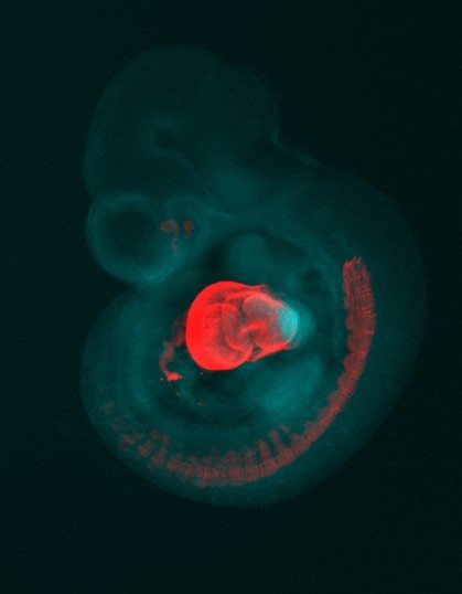 Mouse Heart